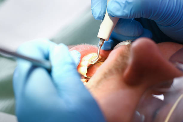 Best Emergency Dentist for Knocked-Out Tooth in Bargaintown, NJ